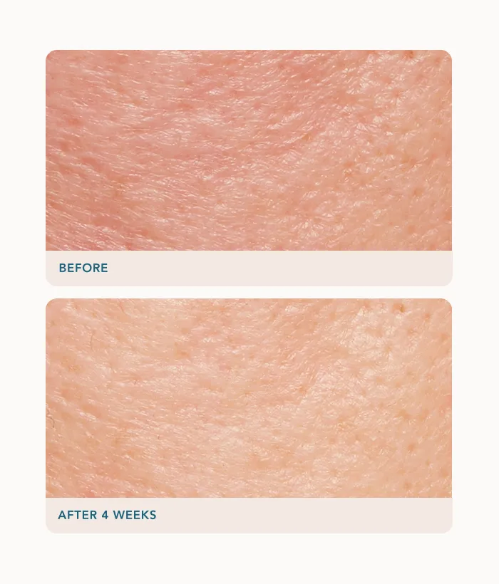 Lancer Retexturizing Treatment Gesichtscreme mit Glykolsäure