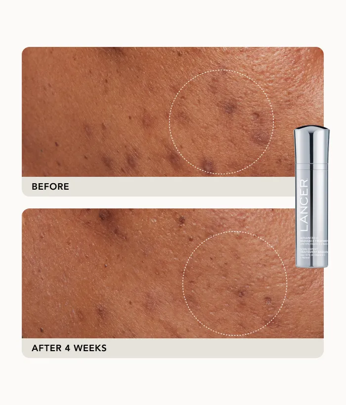 Lancer Advanced Treatment Duo Pflegeset 2tlg Anti-Aging