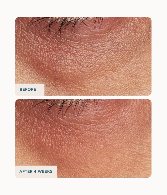 Lancer Eye Contour Lifting Cream Augencreme 0.5 oz straffend