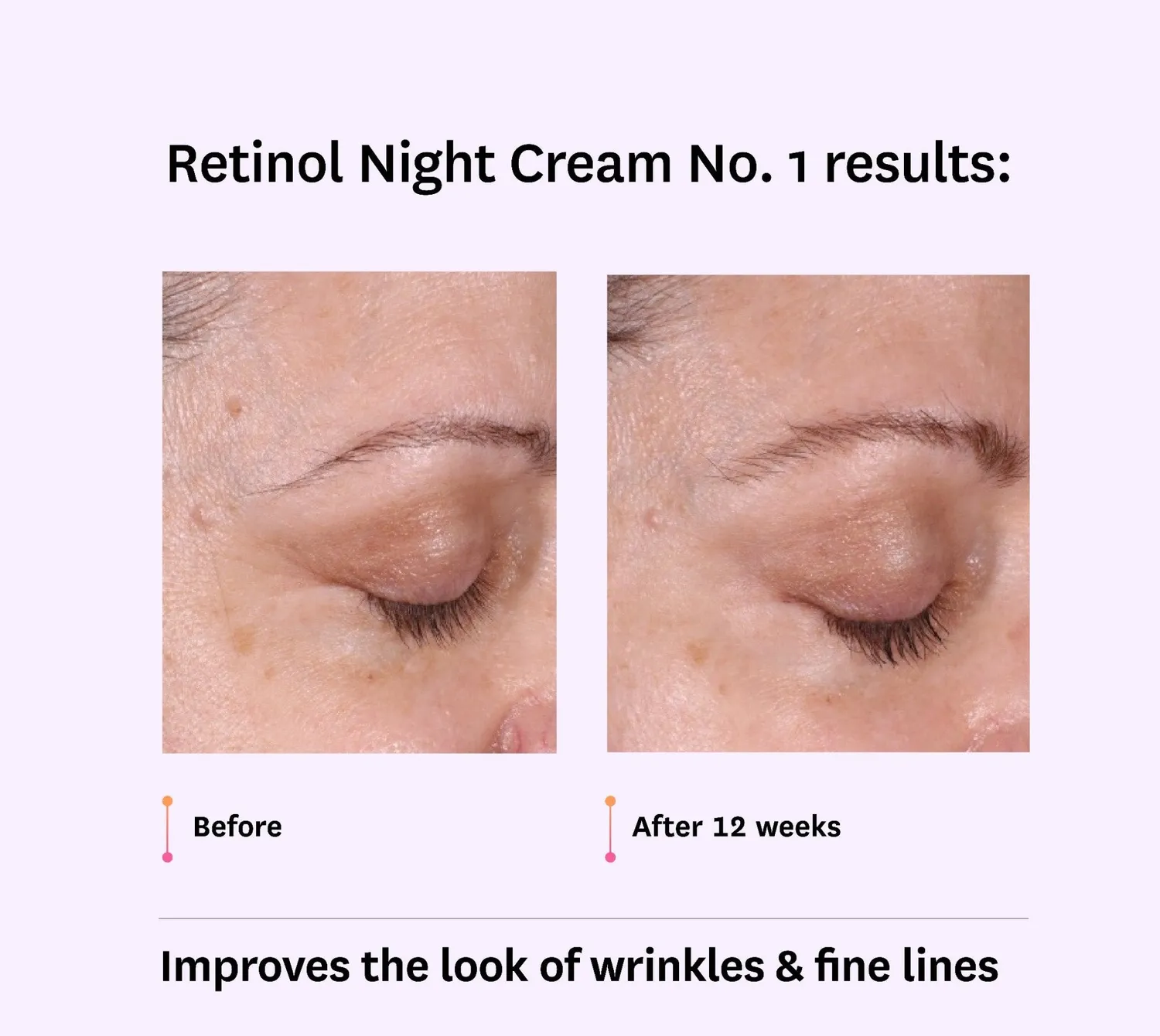 Fig.1 Beauty Intro Retinol Nachtcreme Set 0,15% 0,3%