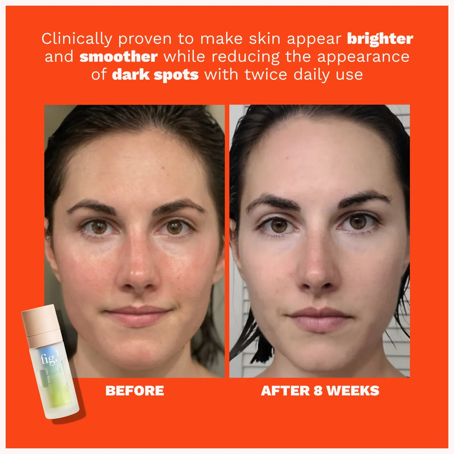 Fig.1 Beauty Brightening Pflegeset Vitamin C Even Tone