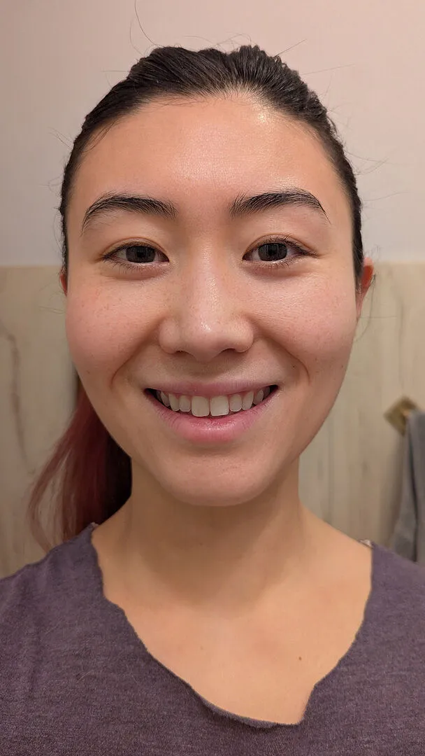 Fig.1 Beauty Retinol Night Cream Level 2 Nachtcreme 0,3% Starter