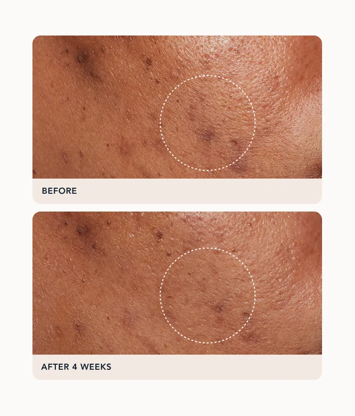 Lancer Advanced C Radiance Treatment Vitamin-C-Creme