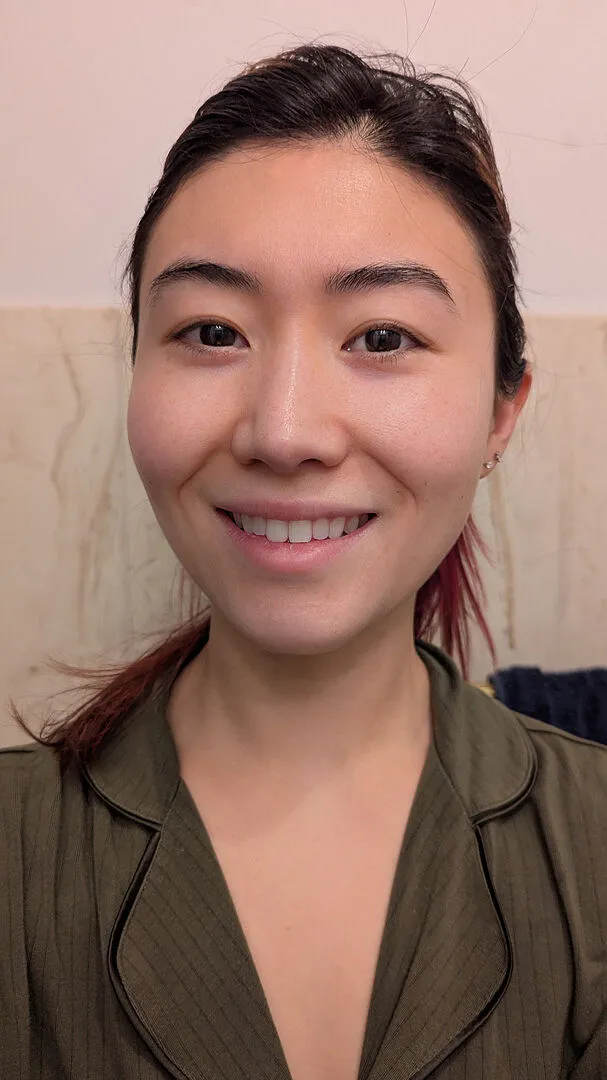 Fig.1 Beauty Retinol Night Cream Level 2 Nachtcreme 0,3% Starter