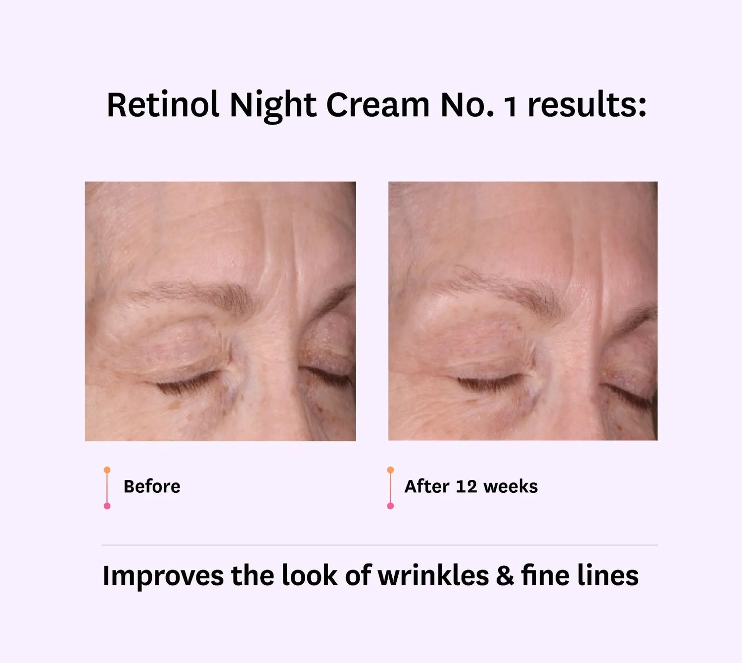Fig.1 Beauty Intro Retinol Nachtcreme Set 0,15% 0,3%