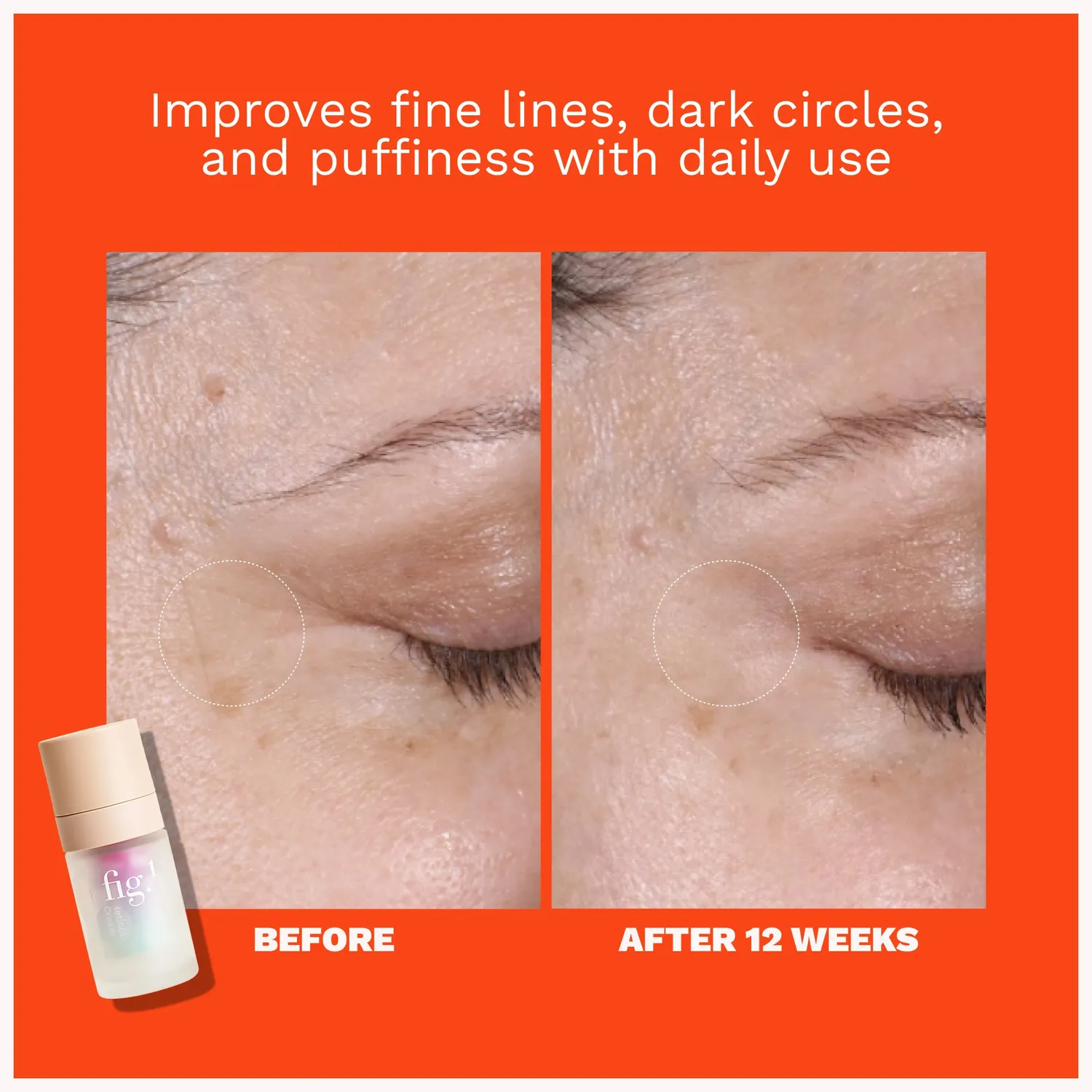 Fig.1 Beauty Firming Set Augen Gesichtscreme Retinol