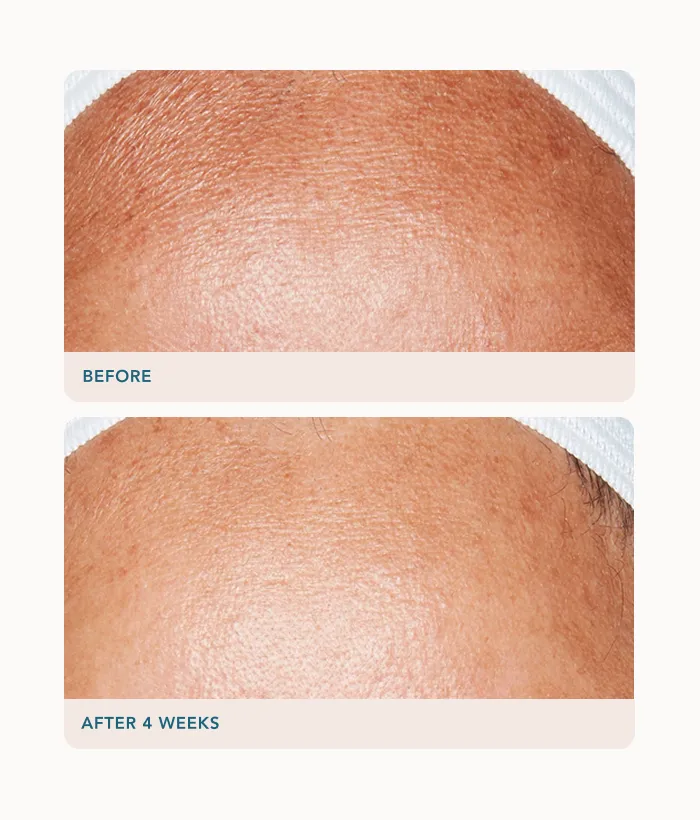 Lancer Advanced Retinol Treatment Serum 1,25% glättend