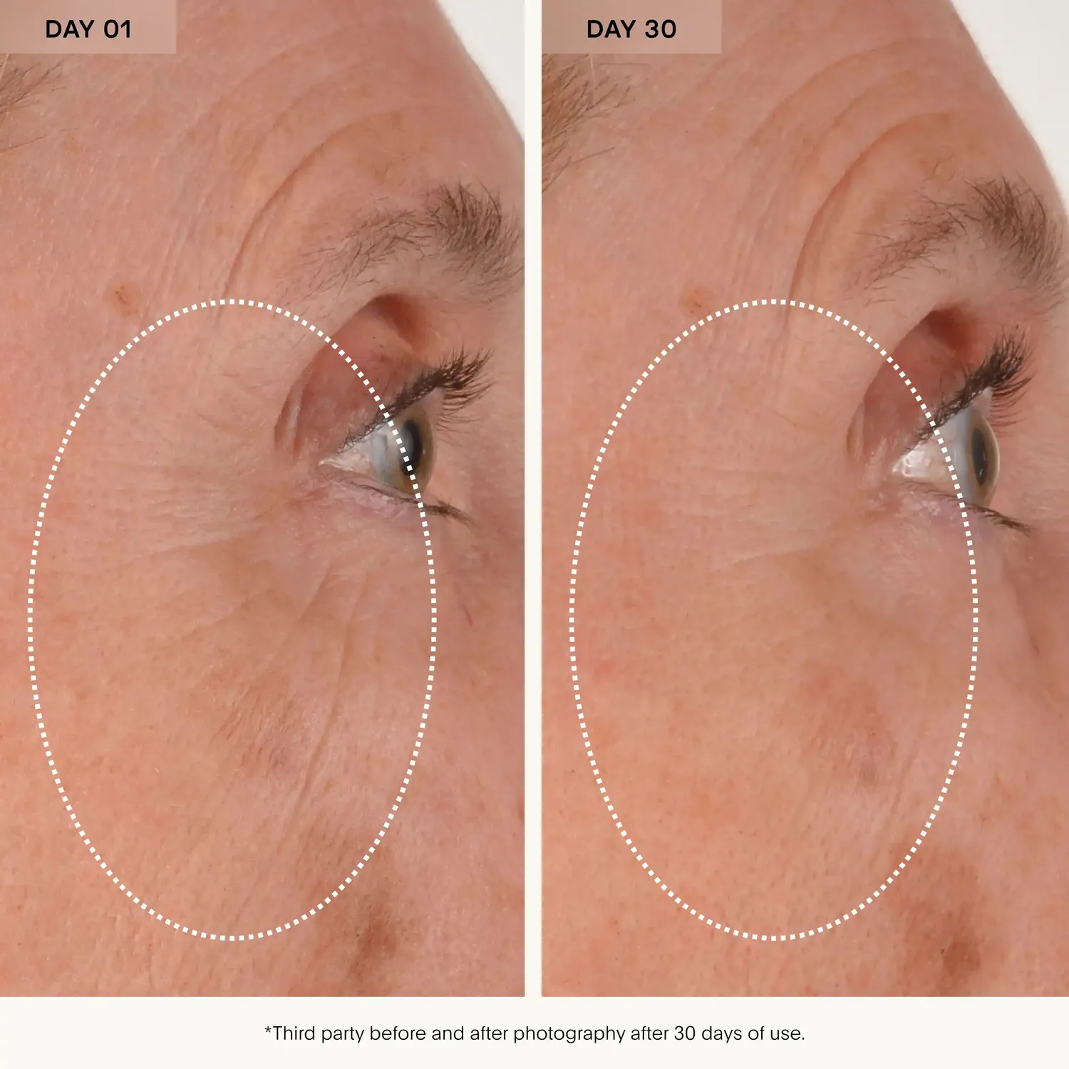 U Beauty RETURN Eye Concentrate Augencreme 15ml glättend