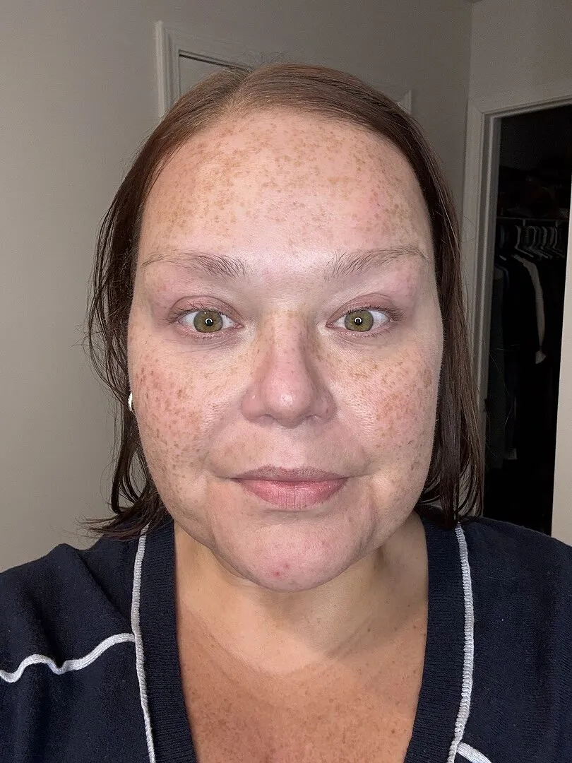 Fig.1 Beauty Retinol Night Cream Level 3 Nachtcreme 0,6%