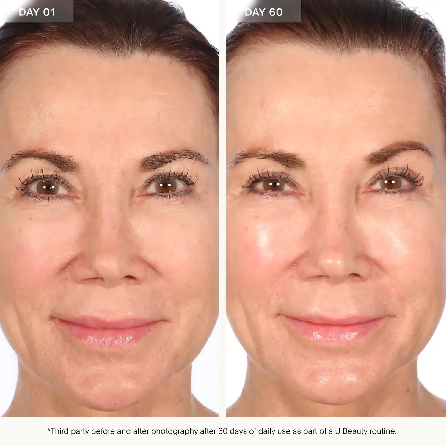 U Beauty Resurfacing Flash Peel Peeling 30ml Glow
