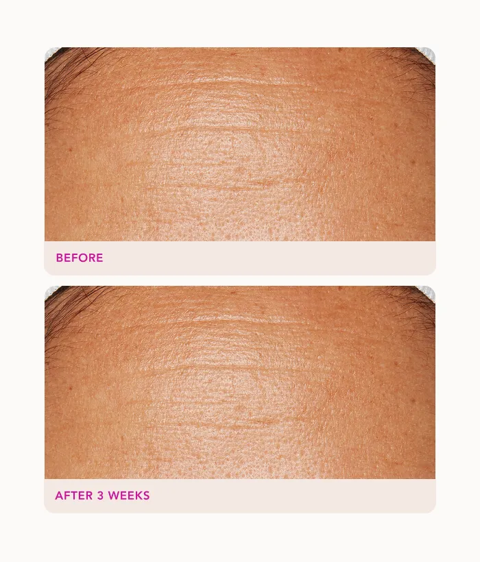 Lancer Gentle Exfoliating Peel Pads Peeling sanft
