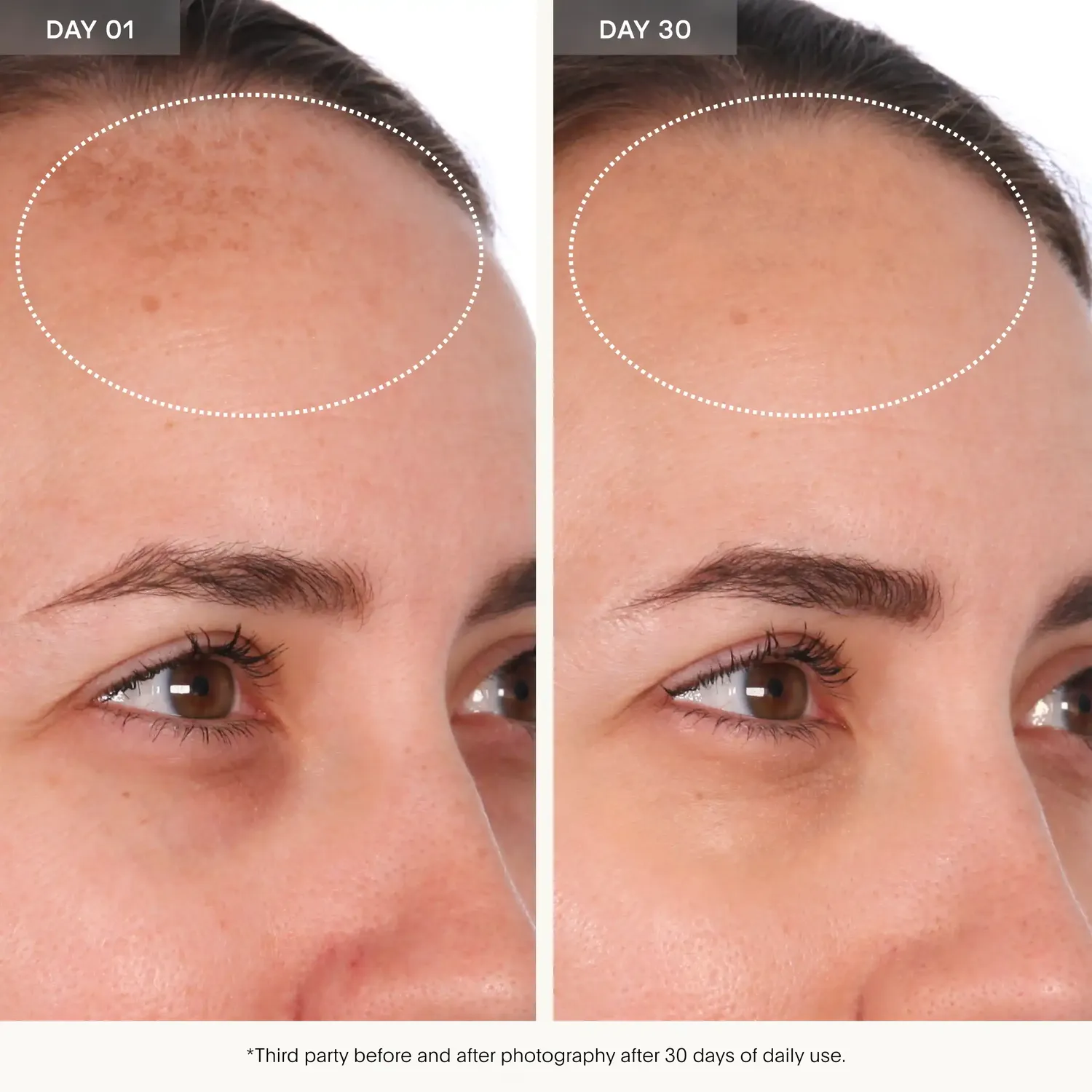 U Beauty Resurfacing Compound Serum 50ml klärend