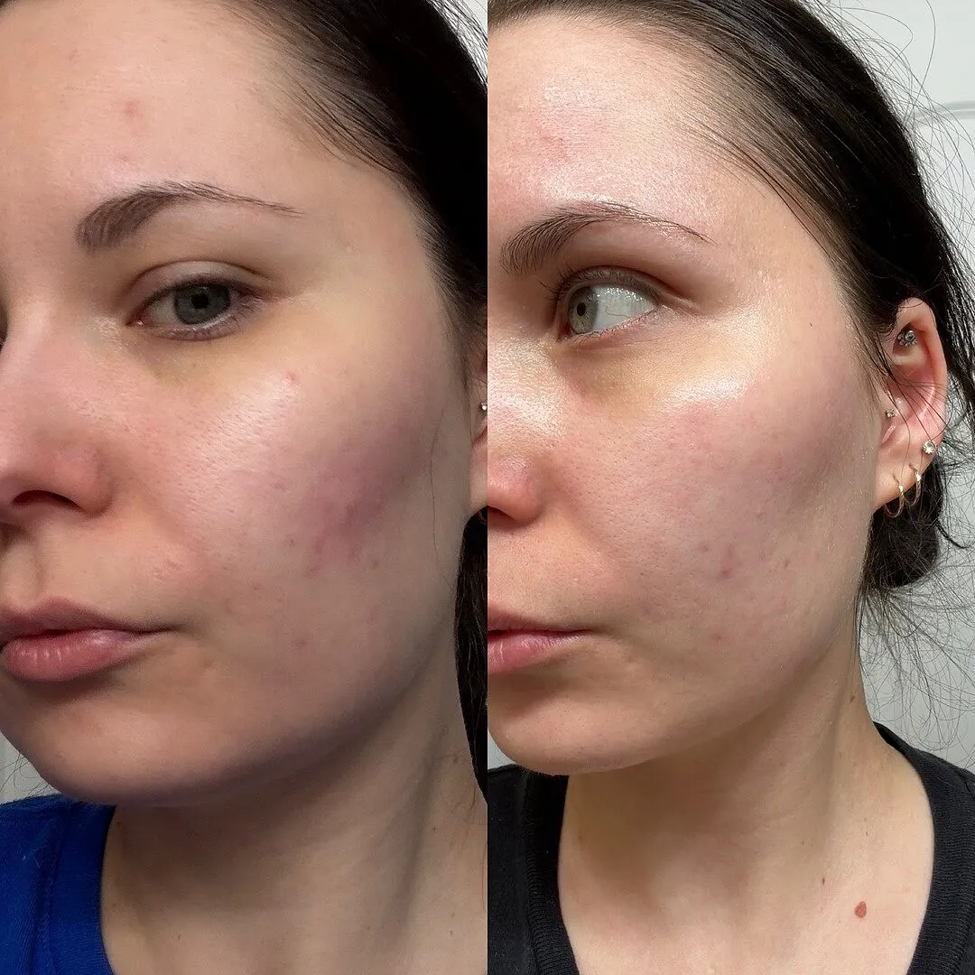 Fig.1 Beauty Micellar Oil Cleanser Deluxe Mini Reinigungsöl