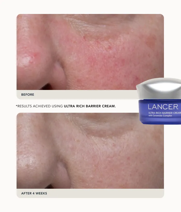 Lancer Peptide Barrier Duo Pflegeset 2tlg festigend