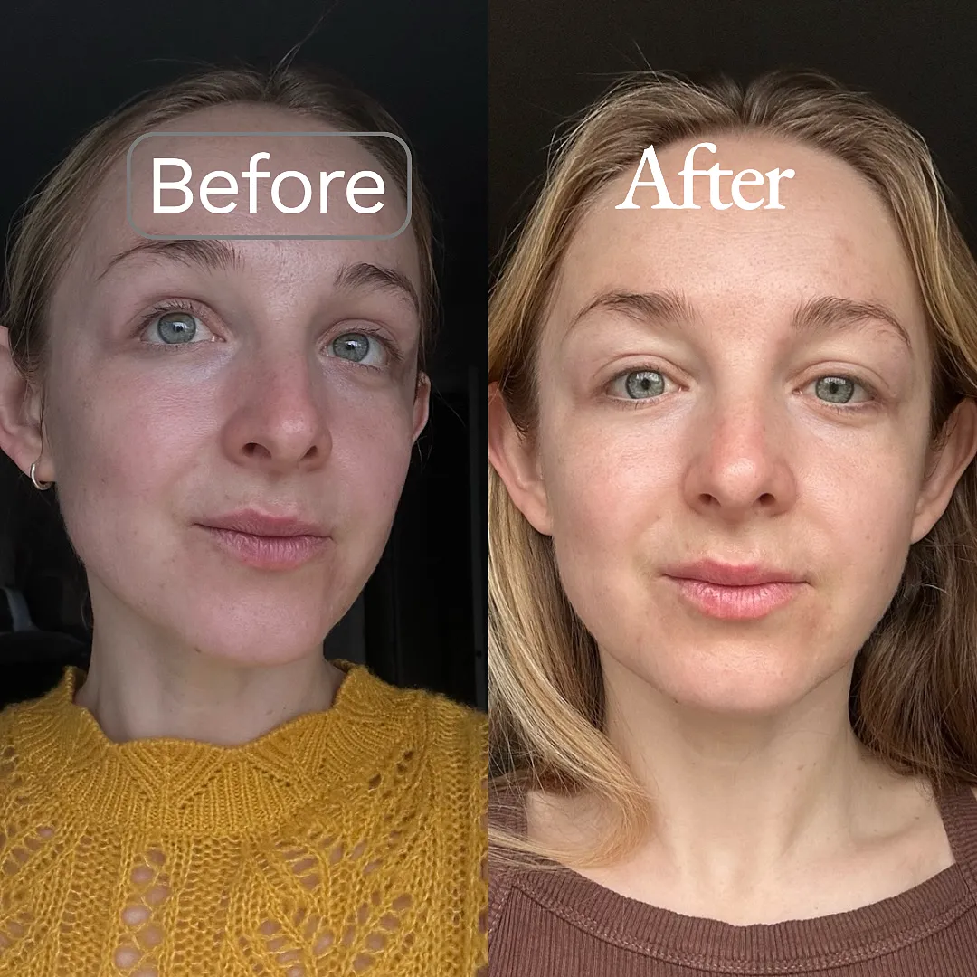 Fig.1 Beauty Vitamin C 15% Treatment Serum Starter Kit L-Ascorbinsäure