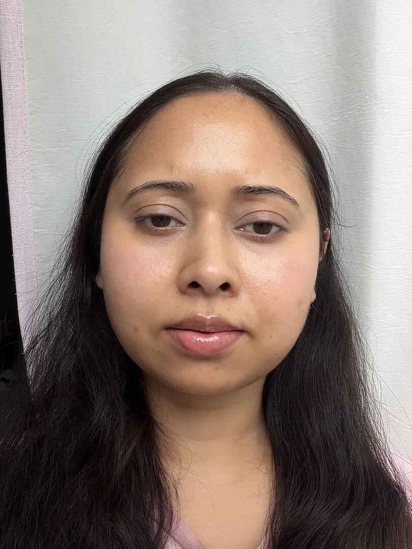 Fig.1 Beauty Ceramide Moisturizer Feuchtigkeitscreme leicht