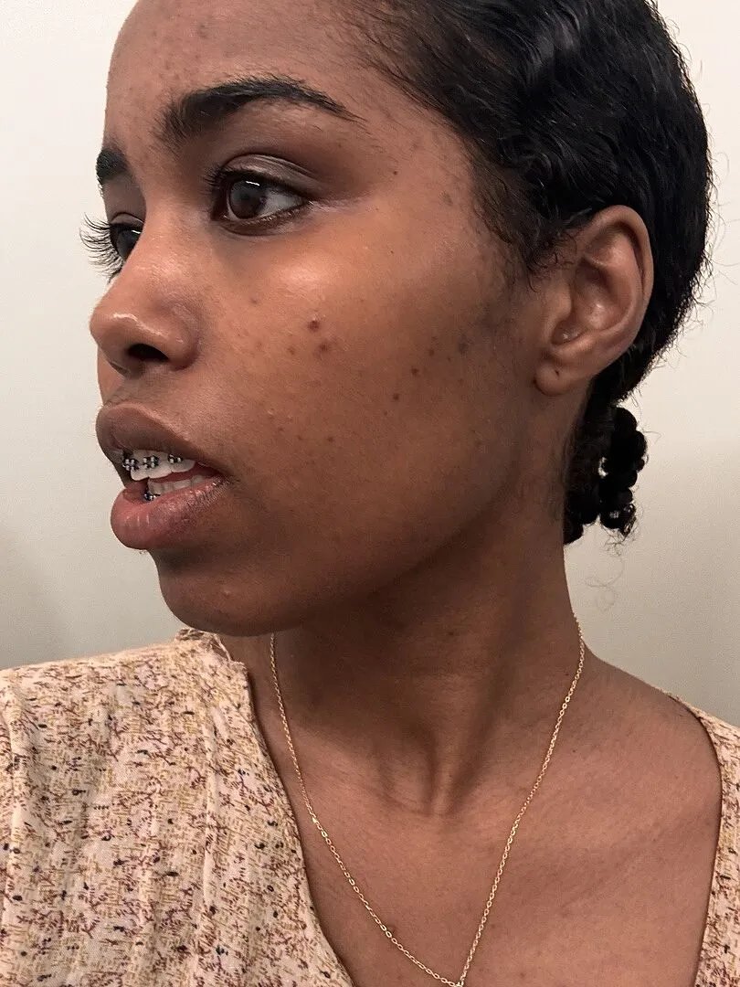 Fig.1 Beauty Even Tone Serum Refill Nachfüllung Tranexamsäure