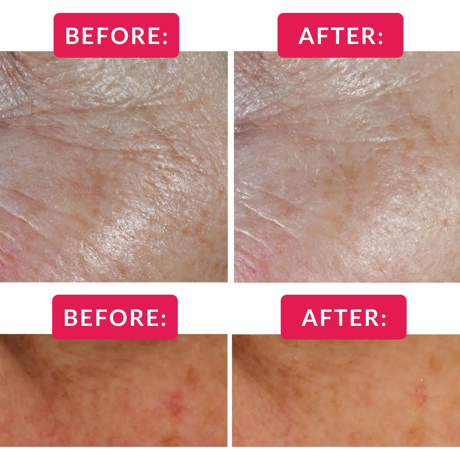 Hada Labo Tokyo Age Correcting Eye Cream Augencreme Hyaluron