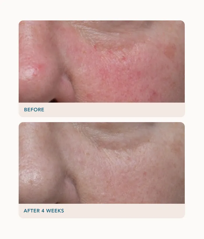 Lancer Ultra Rich Barrier Cream Gesichtscreme trockene Haut