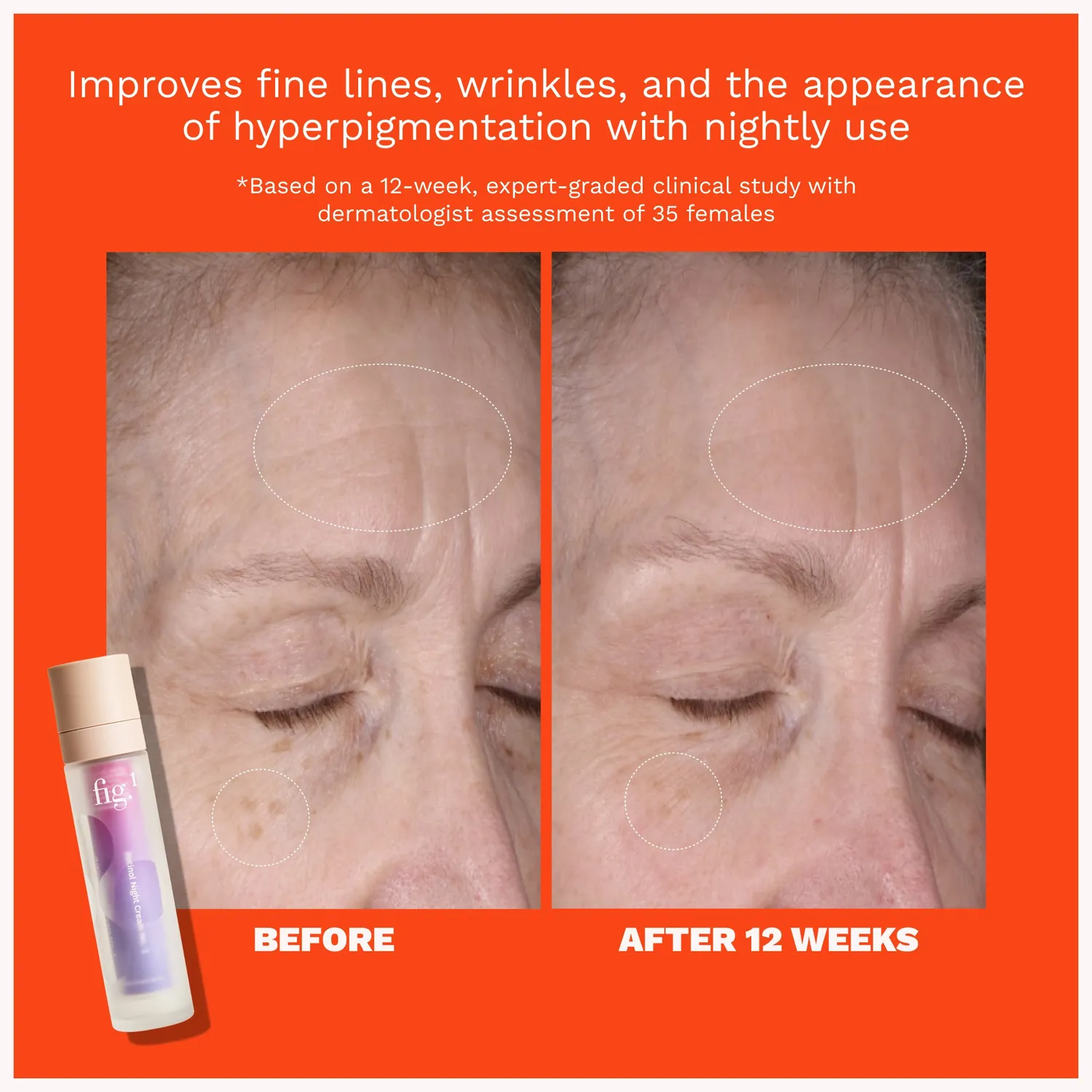 Fig.1 Beauty Retinol Night Cream Level 3 Nachtcreme 0,6%